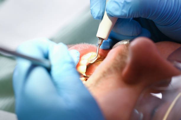 Best Cracked Tooth Emergency Dentist  in Georgiana, AL