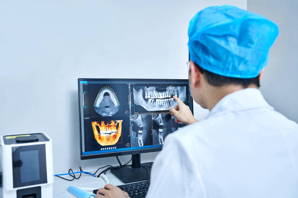 Emergency Dental Filling Replacement in AL